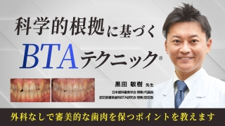 Dr.弘岡に訊く臨床的ペリオ講座 スカンジナビアンアプローチの実際